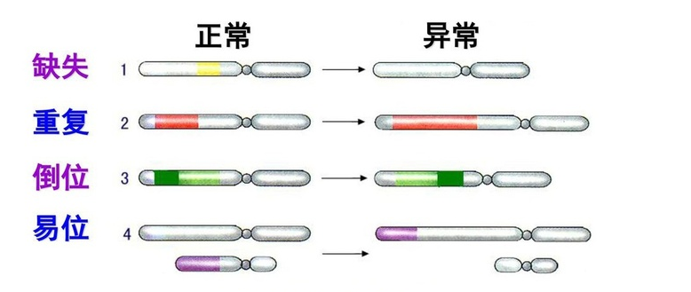 染色体异常