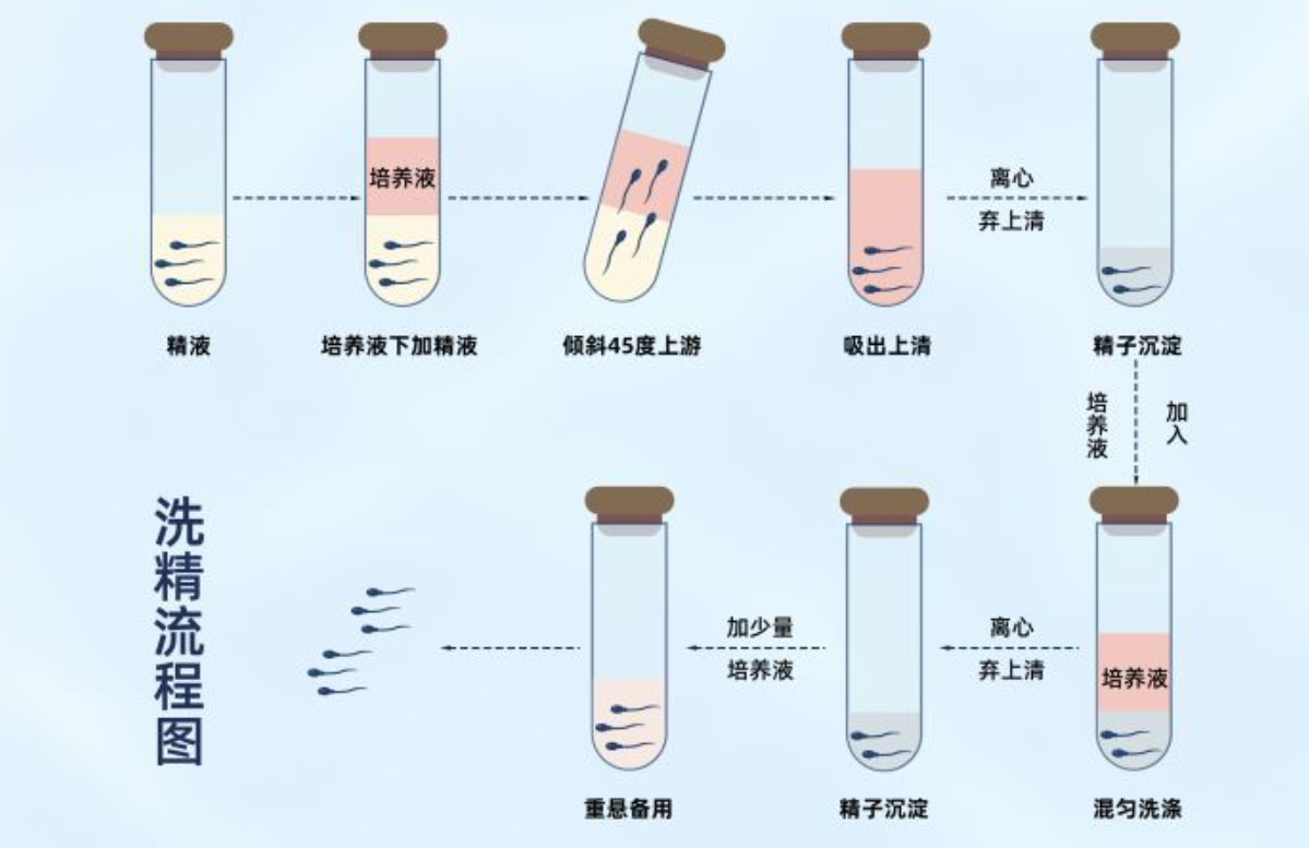 精子洗涤技术