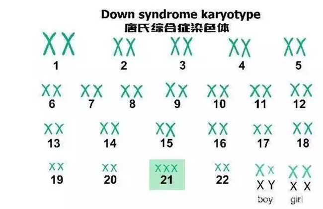 三体综合征