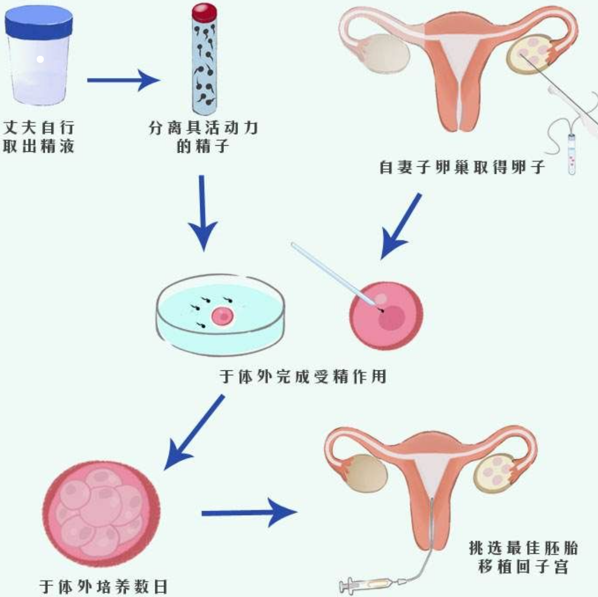 俄罗斯试管婴儿